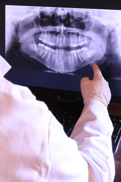Best Broken or Cracked Tooth Emergency Dentist in Shorewood Forest, IN